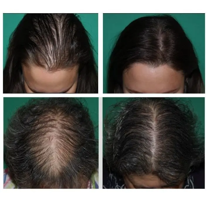 truvarin real results